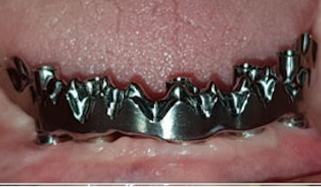 Estructura de Titanio